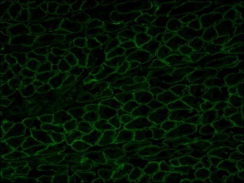 Anti-Dystrophin antibody, Mouse monoclonal clone MANDYS8, purified from hybridoma cell culture