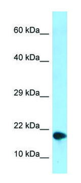 Anti-NUPR1 (C-terminal) antibody produced in rabbit affinity isolated antibody