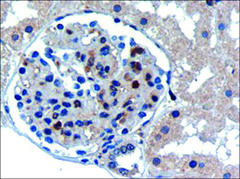 Anti-UBE2I antibody produced in goat affinity isolated antibody, buffered aqueous solution