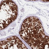 Anti-DDX4 antibody produced in rabbit Prestige Antibodies® Powered by Atlas Antibodies, affinity isolated antibody, buffered aqueous glycerol solution