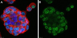 Anti-GLS2 Antibody, clone 3G12 ZooMAb® Rabbit Monoclonal recombinant, expressed in HEK 293 cells
