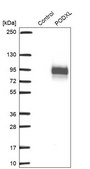Anti-PODXL antibody produced in rabbit Prestige Antibodies® Powered by Atlas Antibodies, affinity isolated antibody, buffered aqueous glycerol solution