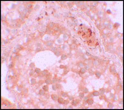 Anti-WDR92 antibody produced in rabbit affinity isolated antibody, buffered aqueous solution