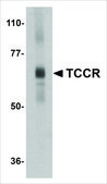 Anti-TCCR (ab2) antibody produced in rabbit affinity isolated antibody, buffered aqueous solution