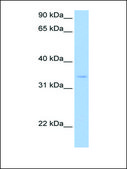 Anti-PDXK antibody produced in rabbit affinity isolated antibody