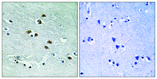 Anti-HDAC6 antibody produced in rabbit affinity isolated antibody