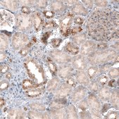 Monoclonal Anti-CLIP1 antibody produced in mouse Prestige Antibodies® Powered by Atlas Antibodies, clone CL4844, purified immunoglobulin, buffered aqueous glycerol solution