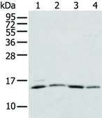 Anti-RPL35A affinity isolated antibody