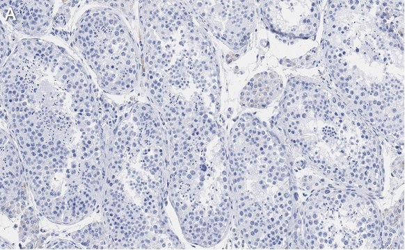 抗Ac-&#945;-微管蛋白(Lys40)抗体，克隆号1L10，ZooMAb&#174;，兔单克隆抗体 recombinant, expressed in HEK 293 cells