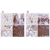 Anti-HLA-DRA antibody produced in rabbit Prestige Antibodies® Powered by Atlas Antibodies, affinity isolated antibody, buffered aqueous glycerol solution