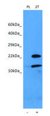 Anti-RPS27A antibody produced in rabbit affinity isolated antibody