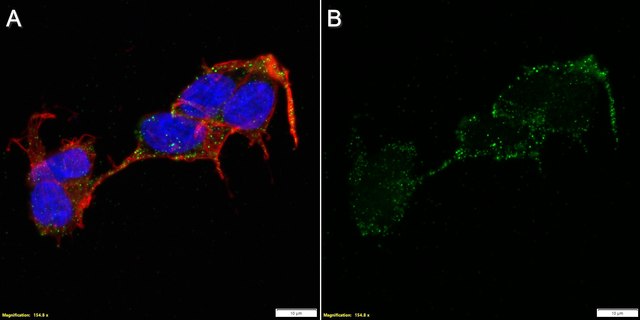 Anti-CHRM4 Antibody, clone 18C7.2 ZooMAb&#174; Mouse Monoclonal recombinant, expressed in HEK 293 cells