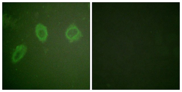 Anti-HER2 antibody produced in rabbit affinity isolated antibody