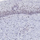 Anti-SIRT7 antibody produced in rabbit Prestige Antibodies® Powered by Atlas Antibodies, affinity isolated antibody, buffered aqueous glycerol solution