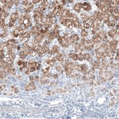 Monoclonal Anti-AMACR antibody produced in mouse Prestige Antibodies® Powered by Atlas Antibodies, clone CL9360, purified immunoglobulin, buffered aqueous glycerol solution