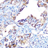 Anti-YB-1/YBX1 antibody produced in rabbit