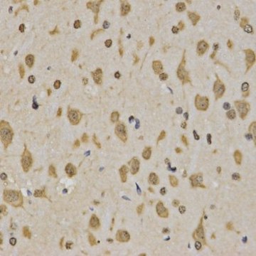 Anti-TriMethyl-Histone H3-K4 antibody produced in rabbit