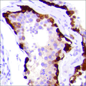 Anti-MAGE-A1 antibody, Rabbit monoclonal clone SP188, recombinant, expressed in proprietary host, affinity isolated antibody