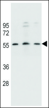 ANTI-KCNK18 (CENTER) antibody produced in rabbit affinity isolated antibody, buffered aqueous solution