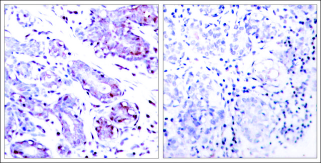 Anti-STAT1 (Ab-701) antibody produced in rabbit affinity isolated antibody