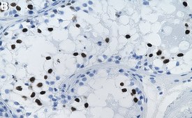 Anti-SCP-3 Antibody, clone 3M19 ZooMAb® Rabbit Monoclonal recombinant, expressed in HEK 293 cells