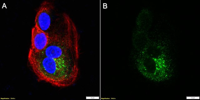 Anti-Trop2 Antibody, clone 2G10 ZooMAb&#174; Mouse Monoclonal recombinant, expressed in HEK 293 cells