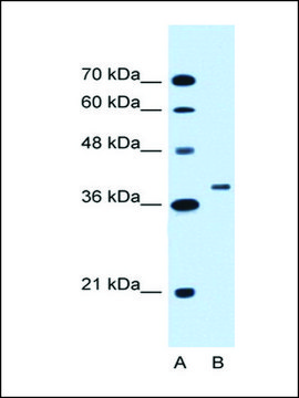 Anti-RNF146 antibody produced in rabbit IgG fraction of antiserum