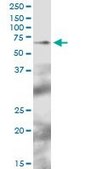 Anti-TFCP2 antibody produced in mouse purified immunoglobulin, buffered aqueous solution