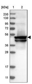 Anti-KRT24 antibody produced in rabbit Prestige Antibodies® Powered by Atlas Antibodies, affinity isolated antibody, buffered aqueous glycerol solution