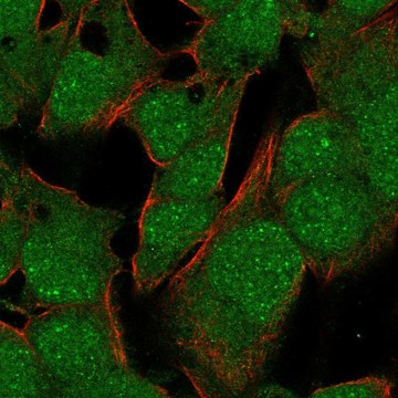 Anti-Tbx10 Antibody Produced In Rabbit Prestige Antibodies&#174; Powered by Atlas Antibodies, affinity isolated antibody, buffered aqueous glycerol solution