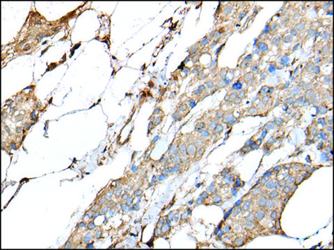 Anti-IL20 affinity isolated antibody