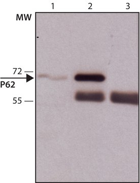 Anti-p62/SQSTM1 antibody produced in rabbit ~1&#160;mg/mL, affinity isolated antibody, buffered aqueous solution