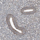 Anti-SAMD3 antibody produced in rabbit Prestige Antibodies® Powered by Atlas Antibodies, affinity isolated antibody, buffered aqueous glycerol solution, ab2