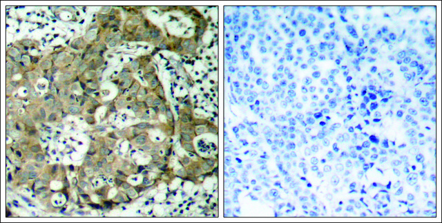 Anti-FOXO1 (Ab-319) antibody produced in rabbit affinity isolated antibody