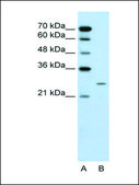 Anti-PLUNC antibody produced in rabbit affinity isolated antibody