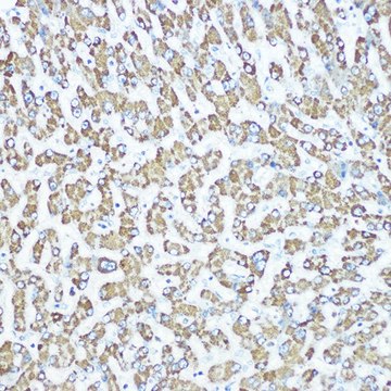 Anti-CPS1 antibody produced in rabbit