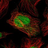 Anti-C2ORF49 antibody produced in rabbit Prestige Antibodies® Powered by Atlas Antibodies, affinity isolated antibody, buffered aqueous glycerol solution