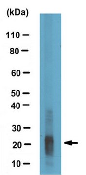 Anti-Amelogenin, X isoform/AMELX Antibody serum, from rabbit