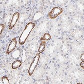 Anti-PBDC1 antibody produced in rabbit Prestige Antibodies® Powered by Atlas Antibodies, affinity isolated antibody, buffered aqueous glycerol solution