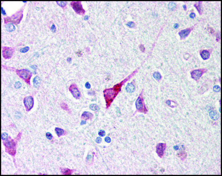 Anti-C1QTNF5 antibody produced in rabbit affinity isolated antibody, buffered aqueous solution