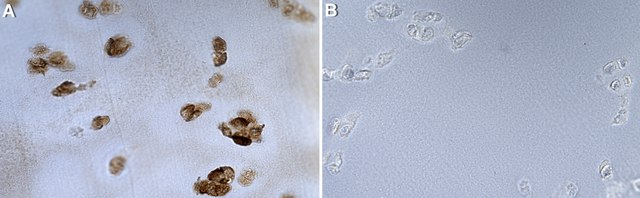 Anti-Keratan sulfate Antibody, clone 373E1