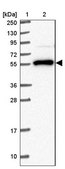 Anti-NACC2 antibody produced in rabbit Prestige Antibodies® Powered by Atlas Antibodies, affinity isolated antibody, buffered aqueous glycerol solution