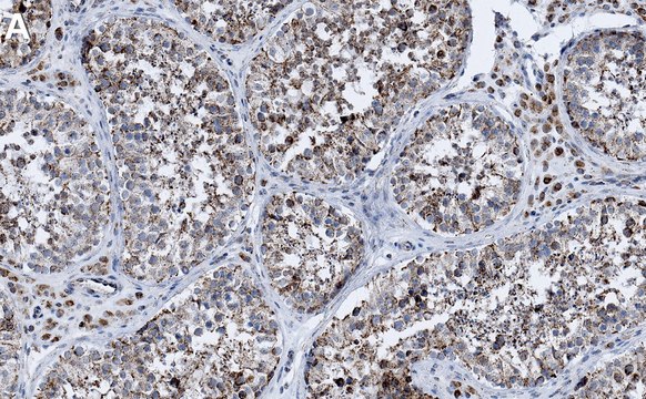 Anti-G3BP1 Antibody, clone 1B10 ZooMAb&#174; Rabbit Monoclonal recombinant, expressed in HEK 293 cells