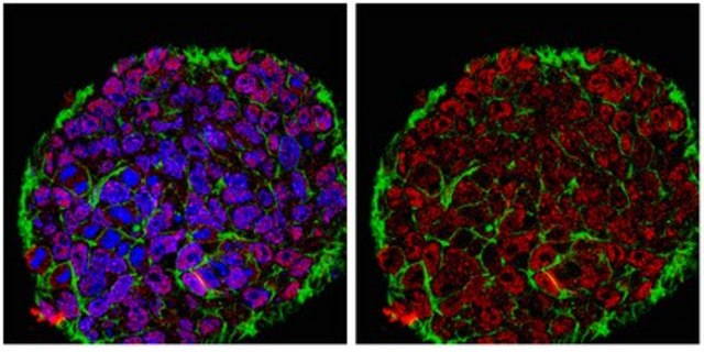 Anti-JARID1D Antibody from rabbit, purified by affinity chromatography