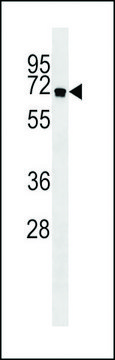 ANTI-ATG16L antibody produced in rabbit purified immunoglobulin, buffered aqueous solution