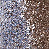 Anti-ATP6V0A1 antibody produced in rabbit Prestige Antibodies® Powered by Atlas Antibodies, affinity isolated antibody, buffered aqueous glycerol solution