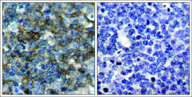 Anti-phospho-VASP (pSer157) antibody produced in rabbit affinity isolated antibody