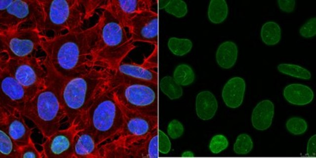 Anti-Lamin A/C Antibody, clone 2A1 clone 2A1, from mouse