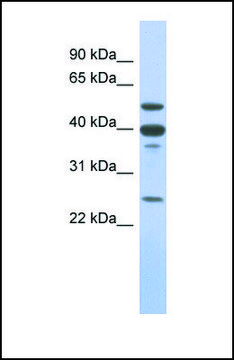 Anti-MMP13 antibody produced in rabbit affinity isolated antibody