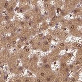 Anti-PSMD1 antibody produced in rabbit Prestige Antibodies® Powered by Atlas Antibodies, affinity isolated antibody, buffered aqueous glycerol solution